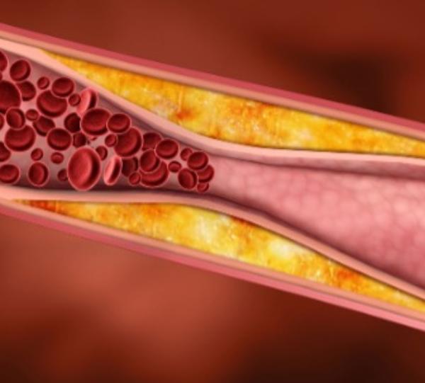 Colesterol y vitamina E.￼
